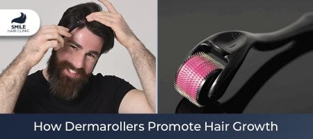 How-Dermarollers-Promote-Hair-Growth