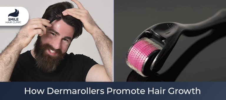 How Dermarollers Prevent Hair Loss And Boost Hair Growth