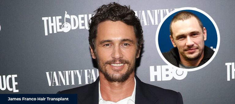 James Franco Saç Ekimi
