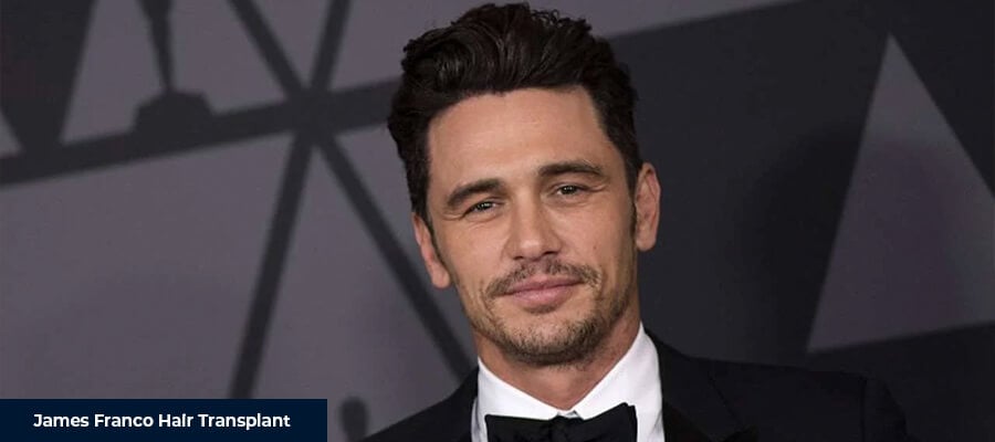 James Franco Saç Ekimi 2 James Franco Saç Ekimi