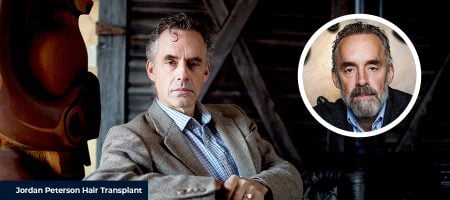 Jordan-Peterson-Before-After