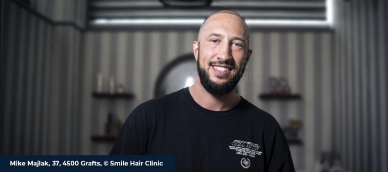 HeyBigMike hier für eine Haartransplantation