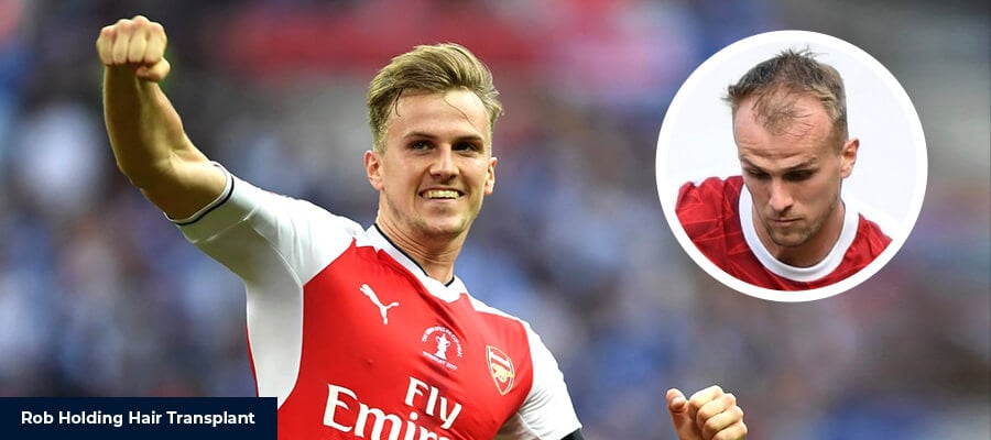 Rob Holding Hair Transplant