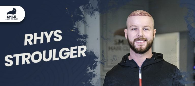 Rhys Stroulger’s 12-Month Hair Transplant Journey