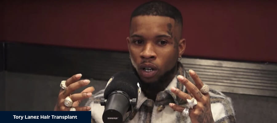 Tory Lanez Saç Ekimi