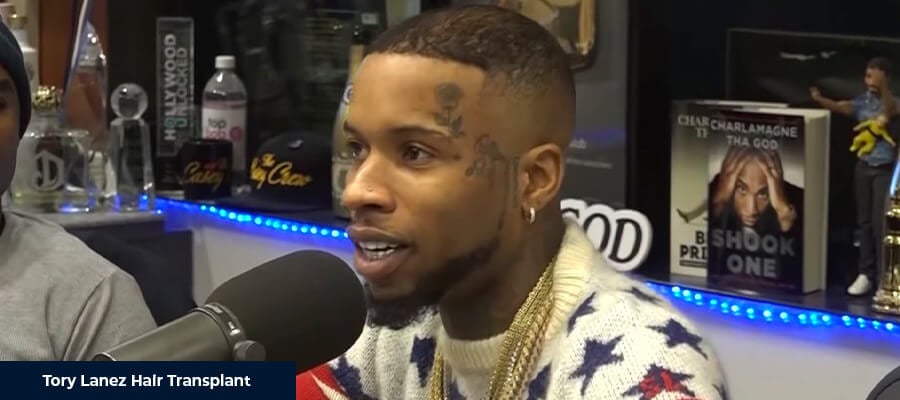 Tory Lanez Saç Ekimi