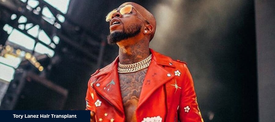Tory Lanez Saç Ekimi