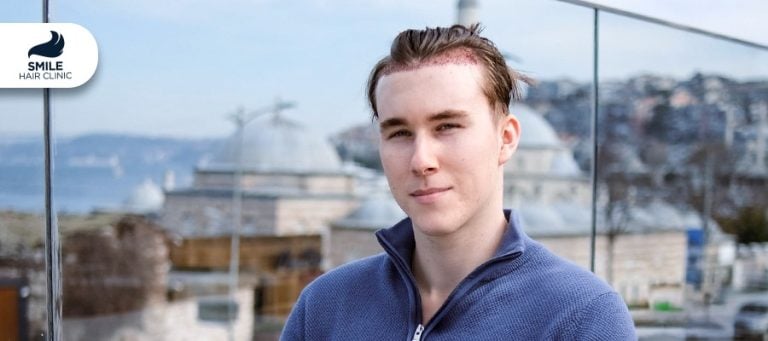 The Global Capital of  Hair Implants