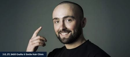 Why-To-Choose-Smile-Hair-Clinic