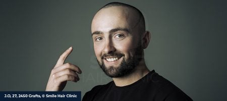 Why-to-choose-Smile-02