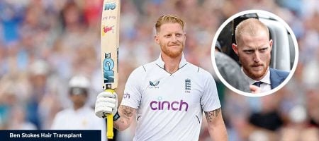 before-after-ben-stokes