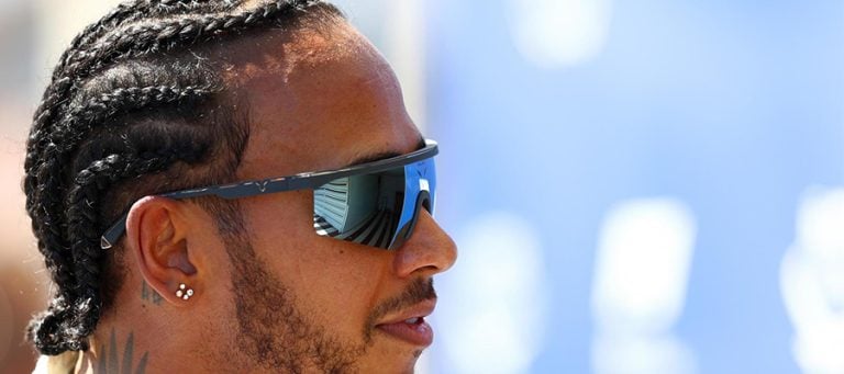 Lewis Hamilton’ın Saç Ekimi