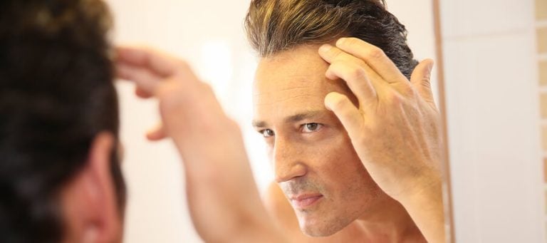 Hair Transplant in Miami