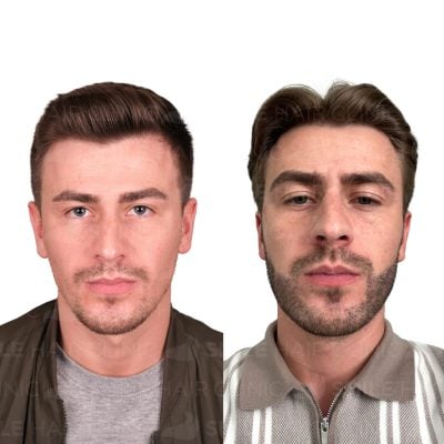 3500 Grafts - LIAM RICHARDSON