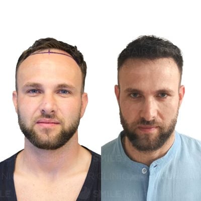 3700 Grafts - FRANSICS VODNAR LUDOVIC