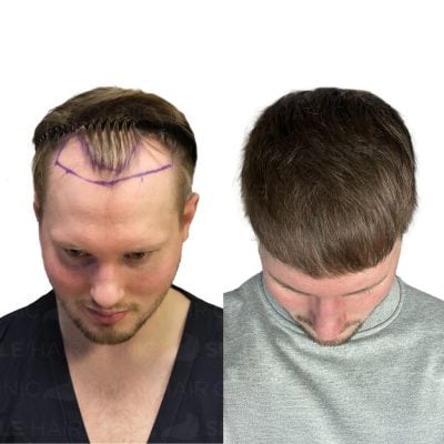 3700 Grafts - JAMIE TURNER