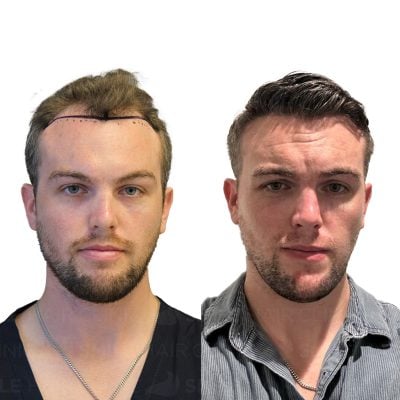 3900 Grafts - TYLER JAMES SNODDY