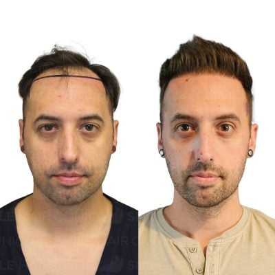 4100 Grafts - TERENCE GILL