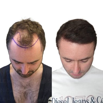 4150 Grafts - LIAM EGAN