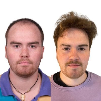 4300 Grafts - ODIN JEAN AADLAND