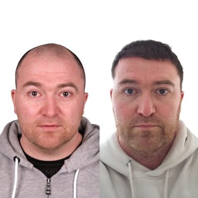 4350 Grafts - ANDREW LIVESEY