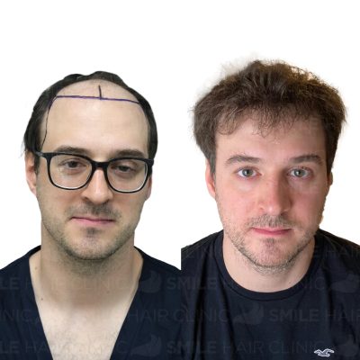 4750 Grafts - RAFAL SIEKANSKI