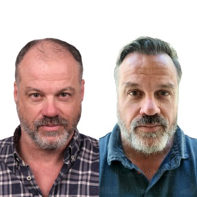 5300 Grafts - DAVID SCRUGGS