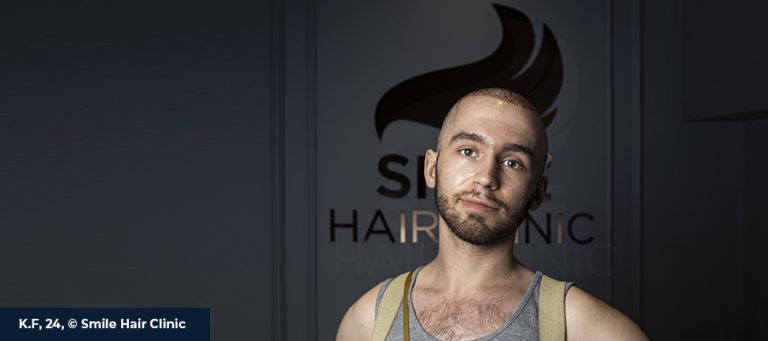 HAARTRANSPLANTATION & DIE LOKALANÄSTHESIE