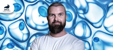 Exosome-Therapy-for-hair-loss