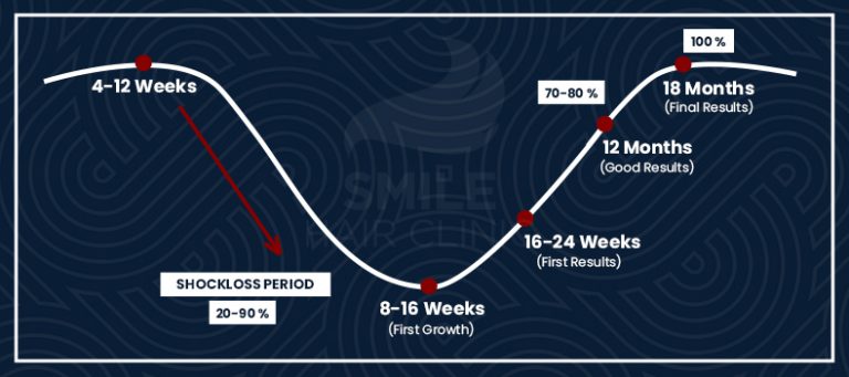 Körperhaartransplantation