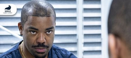 Hair-Transplant-in-Texas