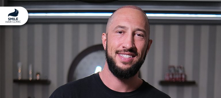 5 Reasons Americans Choose Smile Hair Clinic for Hair Restoration