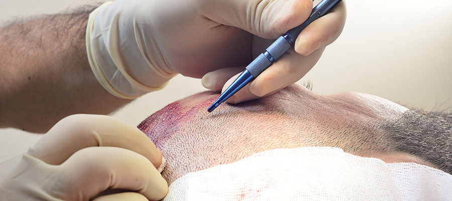 MBJELLJA E FLOKËVE ME MIKRO FUE