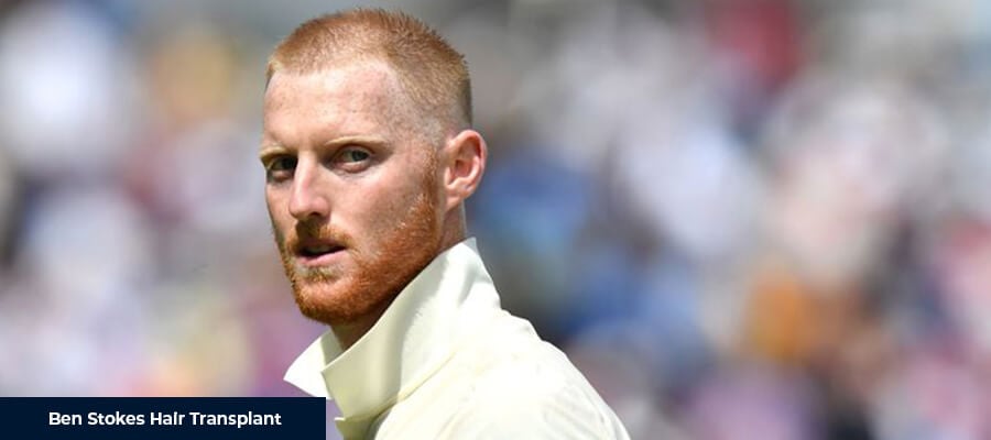 Ben Stokes Saç Ekimi