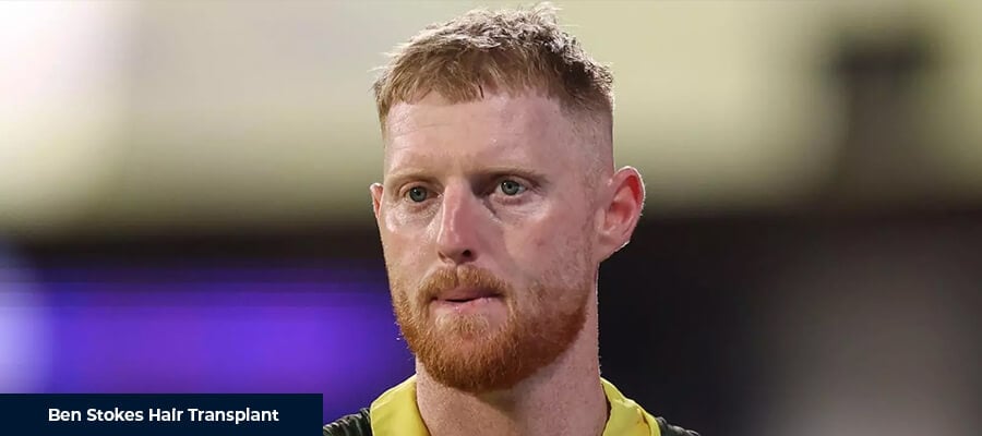 Ben Stokes Saç Ekimi