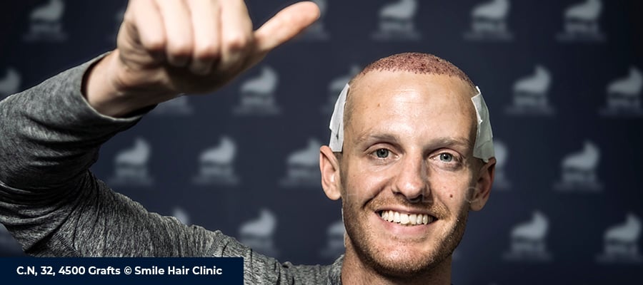 Hair Treatment Mesotherapy