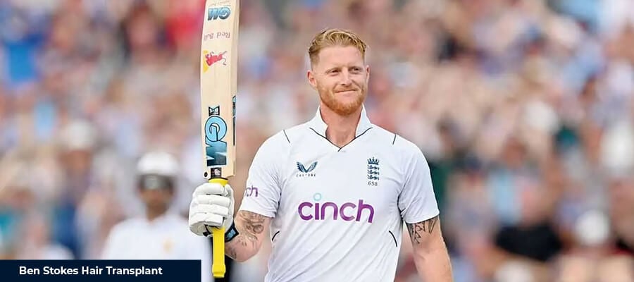 Ben Stokes Saç Ekimi