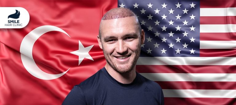 Hair Transplant USA vs Turkey