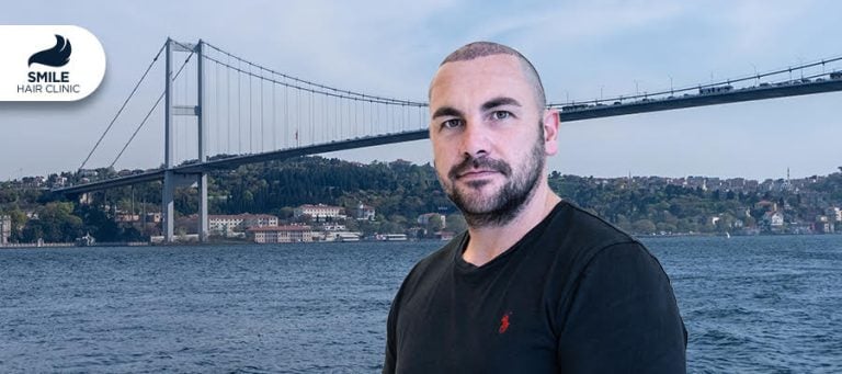 Why Do People Travel Turkey for Hair Transplant: The Complete Guide to Medical Tourism