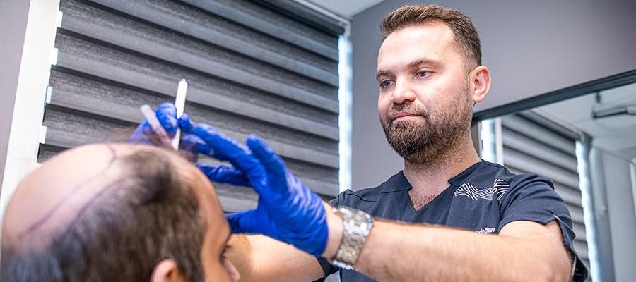 how to hair transplant doctors use norwood scale
