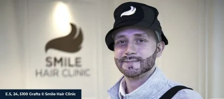 Moustache-Transplant