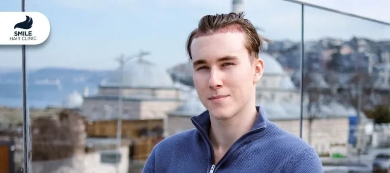 Is Turkey Safe for a Hair Transplant in 2026? A Patient Safety Checklist