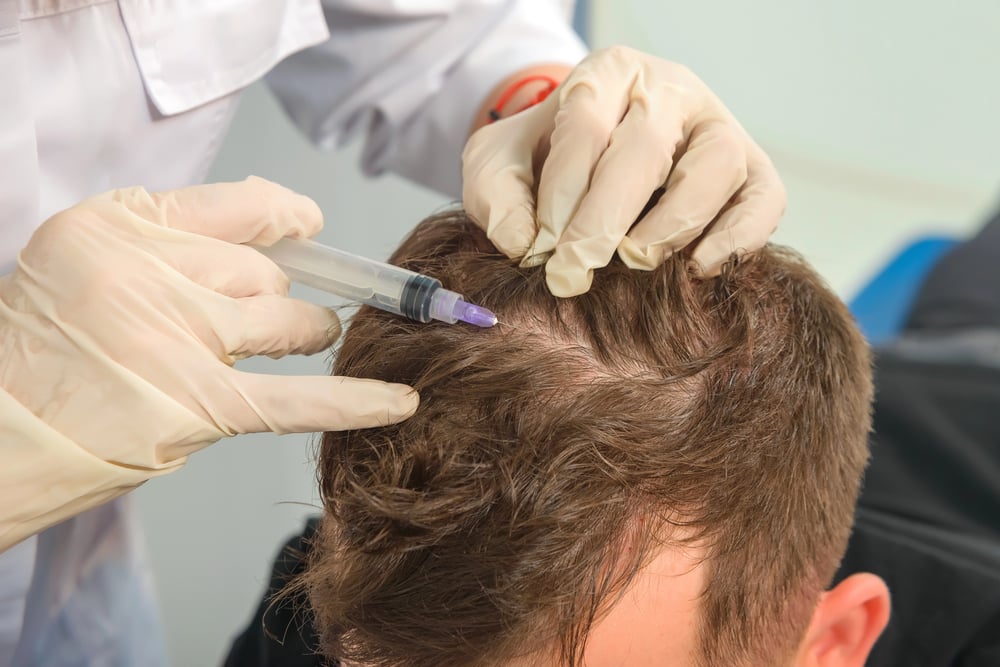 Hair Treatment Mesotherapy