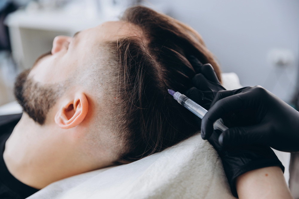 Hair Treatment Mesotherapy