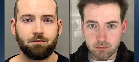 hair-transplant-turkey-before-after