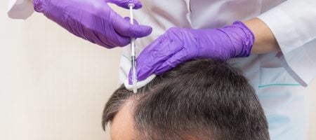 prp-hair-treatment-turkey