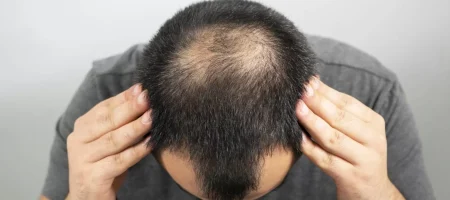 shock-loss-vs-shedding-2000x750