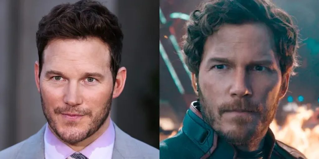 Chris Pratt Hair Transplant: Before & After Hairline Analysis Guide