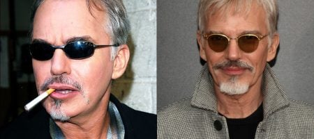 billy-bob-thornton-hair-transplant-review