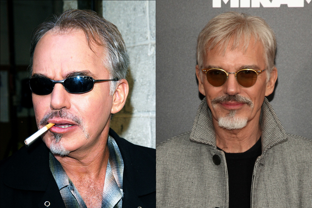 does billy bob thornton actually smoke cigarettes Billy Bob Thornton Hair Transplant: Hairline Analysis & Natural Results  Guide